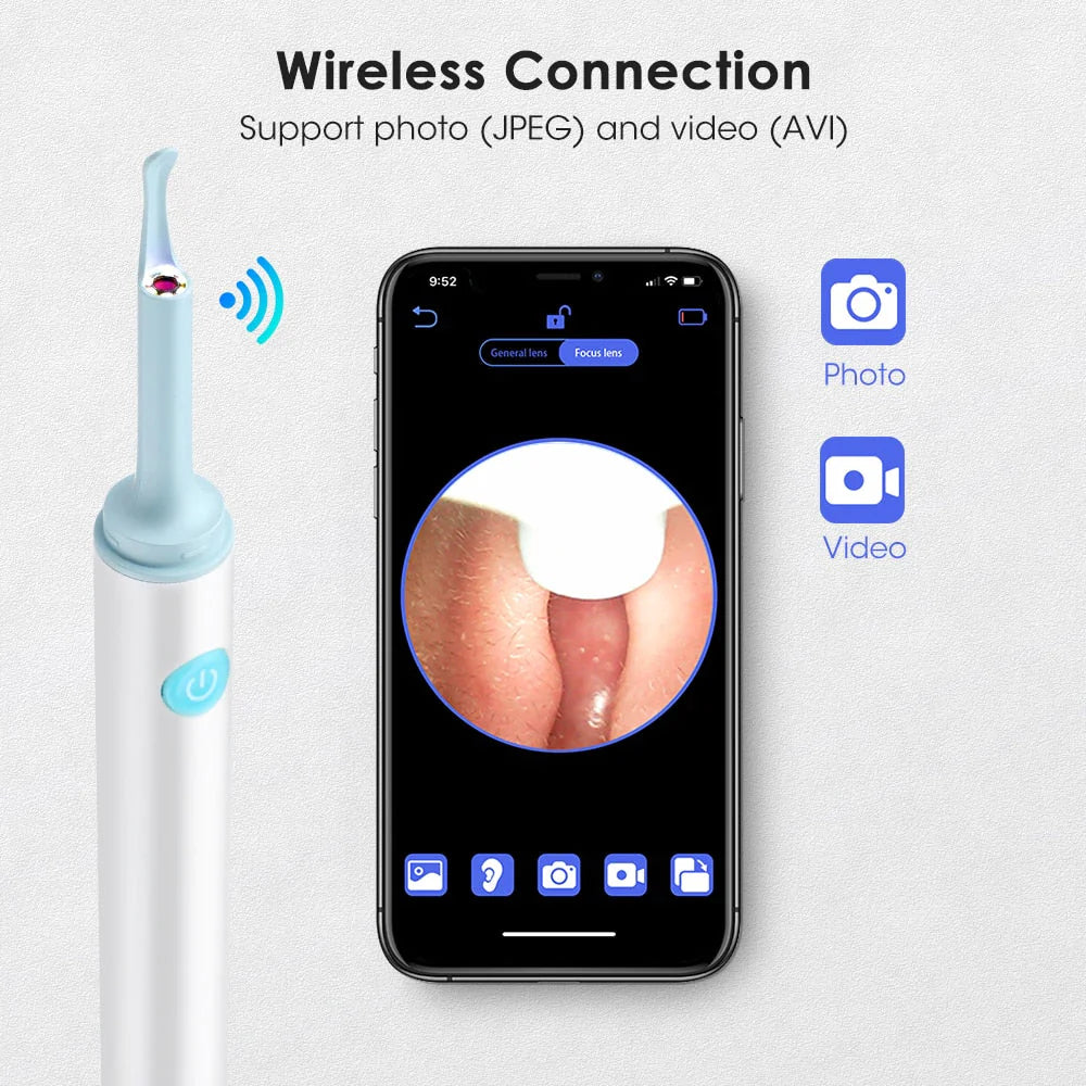 Otoscope sans fil Outil de retrait de cérumen