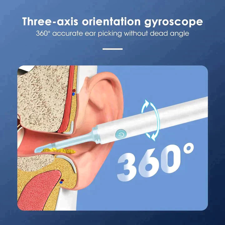 Otoscope sans fil Outil de retrait de cérumen